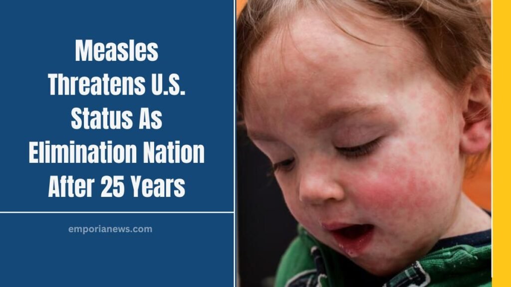 Measles Threatens U.S. Status As Elimination Nation After 25 Years