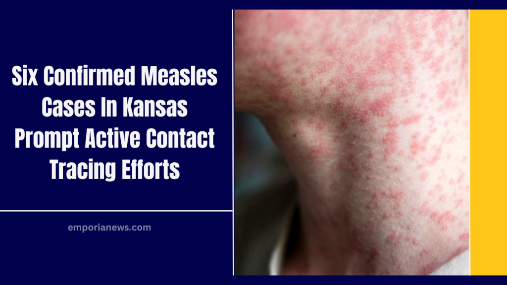 Six Confirmed Measles Cases In Kansas Prompt Active Contact Tracing Efforts