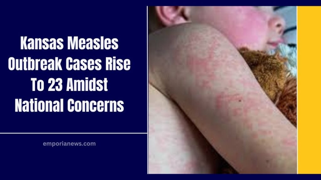 Kansas Measles Outbreak Cases Rise To 23 Amidst National Concerns