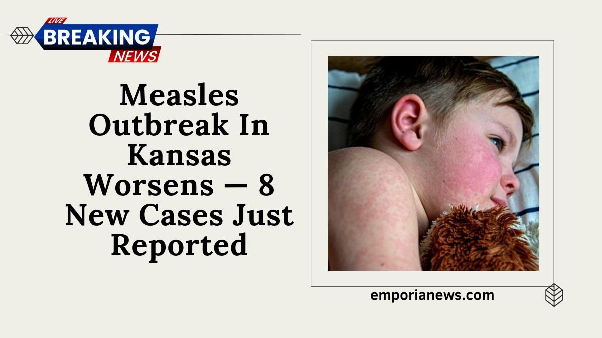 Measles Outbreak In Kansas Worsens — 8 New Cases Just Reported