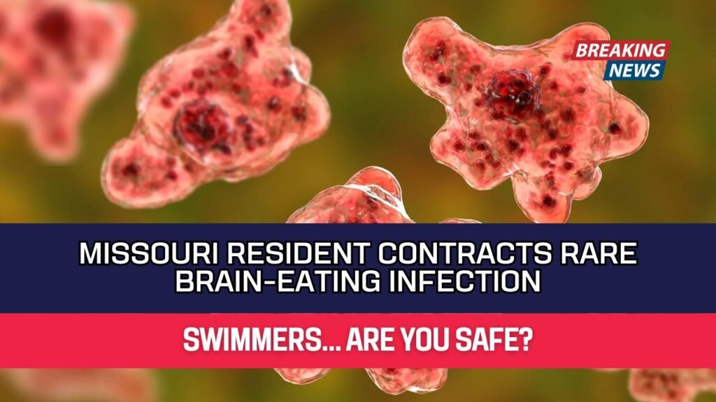 Missouri Resident Contracts Rare Brain-Eating Infection