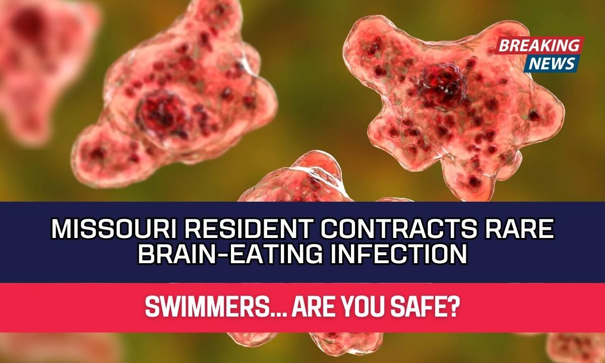 Missouri Resident Contracts Rare Brain-Eating Infection